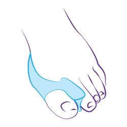 СТ-52 Межпальцевая перегородка, совмещенная с протектором сустава