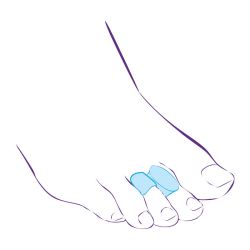 СТ-54.6 Перегородка межпальцевая с протектором,совмещенная с протектором сустава